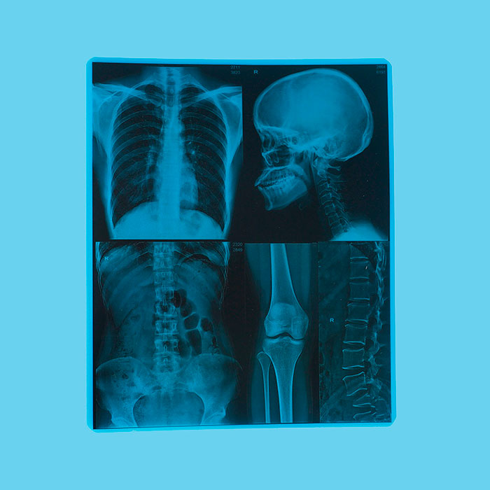 醫(yī)用干式激光膠片