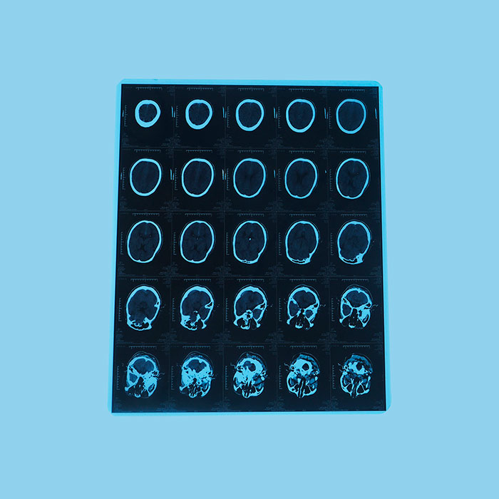 醫(yī)用激光膠片